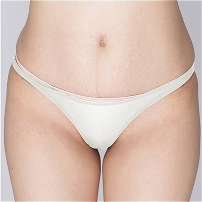 �ɔ��X�g���b�`�n�C���O�n�[�t�o�b�N�@�z���C�g�i�����W�F���[�j