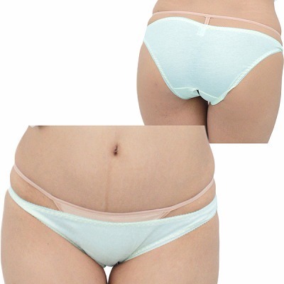 �L�k�����Q�R�b�g���ҊJ���t���o�b�N�@�T�b�N�X�i�����W�F���[�j